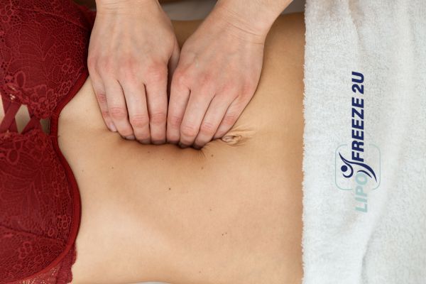 diastasis recti treatment Scottish