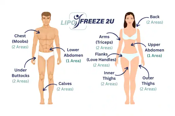 Areas you can have fat freezing treatment Scottish