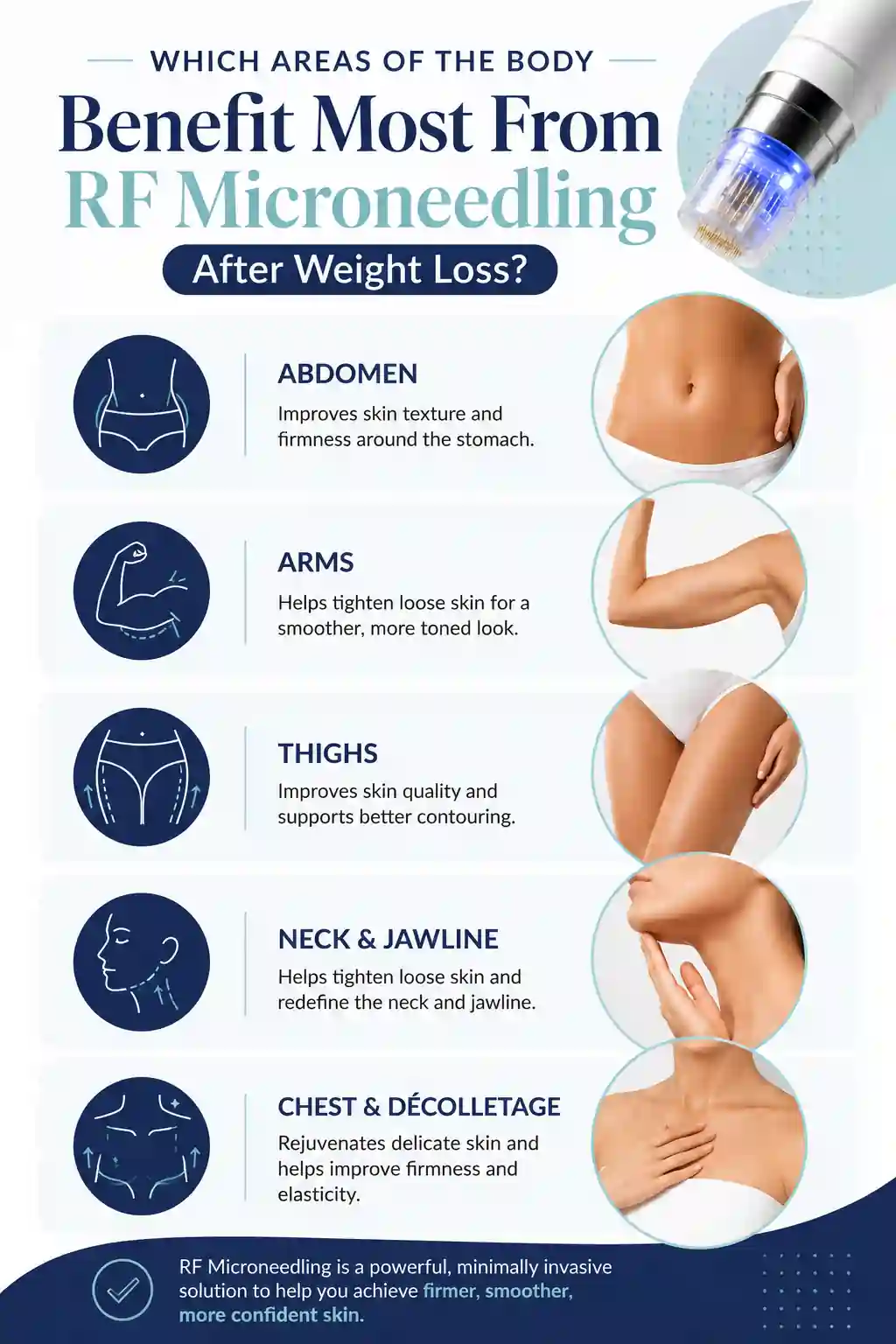 Which Areas of the Body Benefit Most From RF Microneedling After Weight Loss Scottish